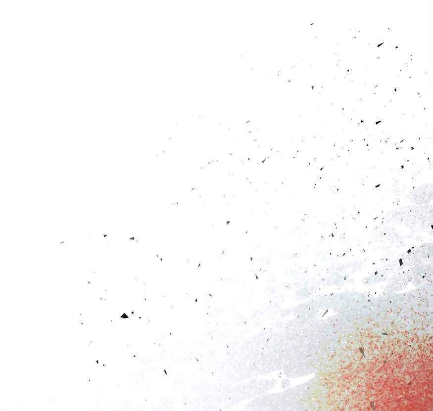 51 Cómo rechazar la obsesión de mi ex esposo